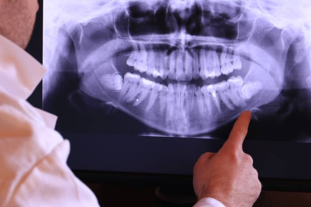 Best Pediatric Emergency Dentist in Rock Island, WA