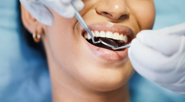 Best Emergency Root Canal Treatment in Rock Island, WA
